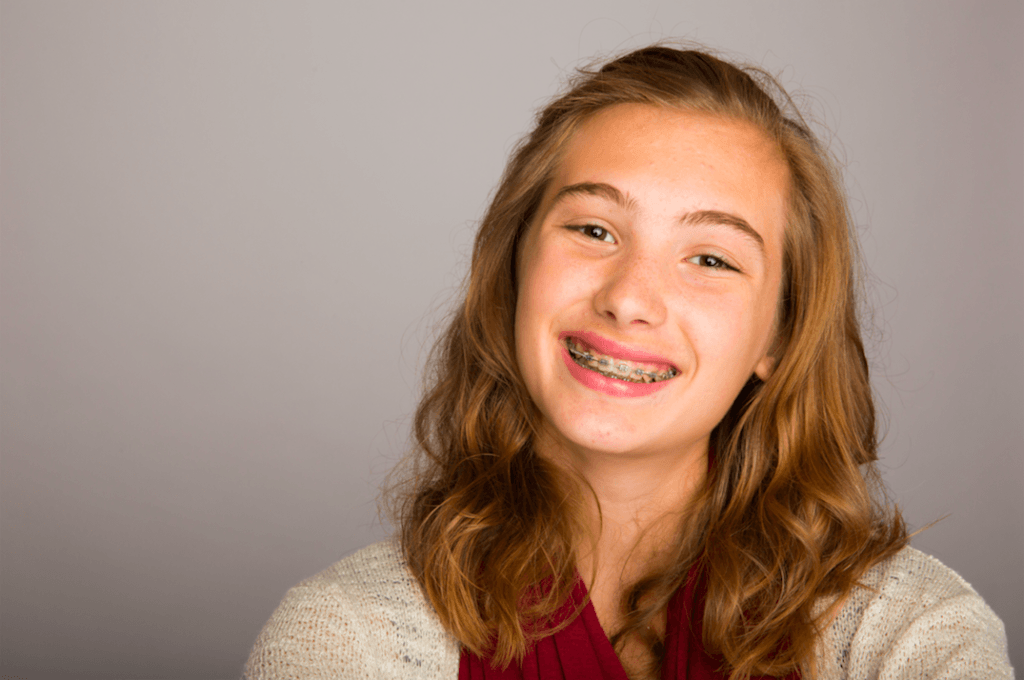 How Much Do Braces Cost? Mobile AL Braces Orthodontics